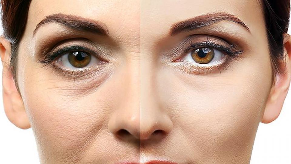Avere un contorno occhi radioso, illuminato e ringiovanito è il sogno di qualsiasi donna ?