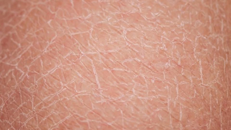 l’importanza dell’idratazione cutanea